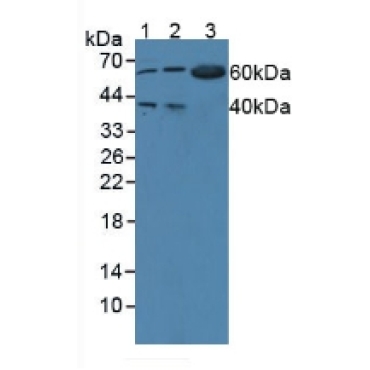 Tryptophanyl tRNA Synthetase (WARS) Human Polyclonal Antibody