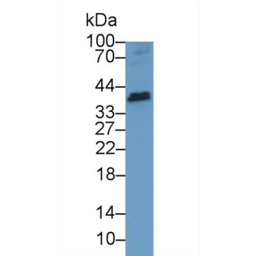 Tumor Necrosis Factor Ligand Superfamily, Member 13 (TNFSF13) Human Polyclonal Antibody