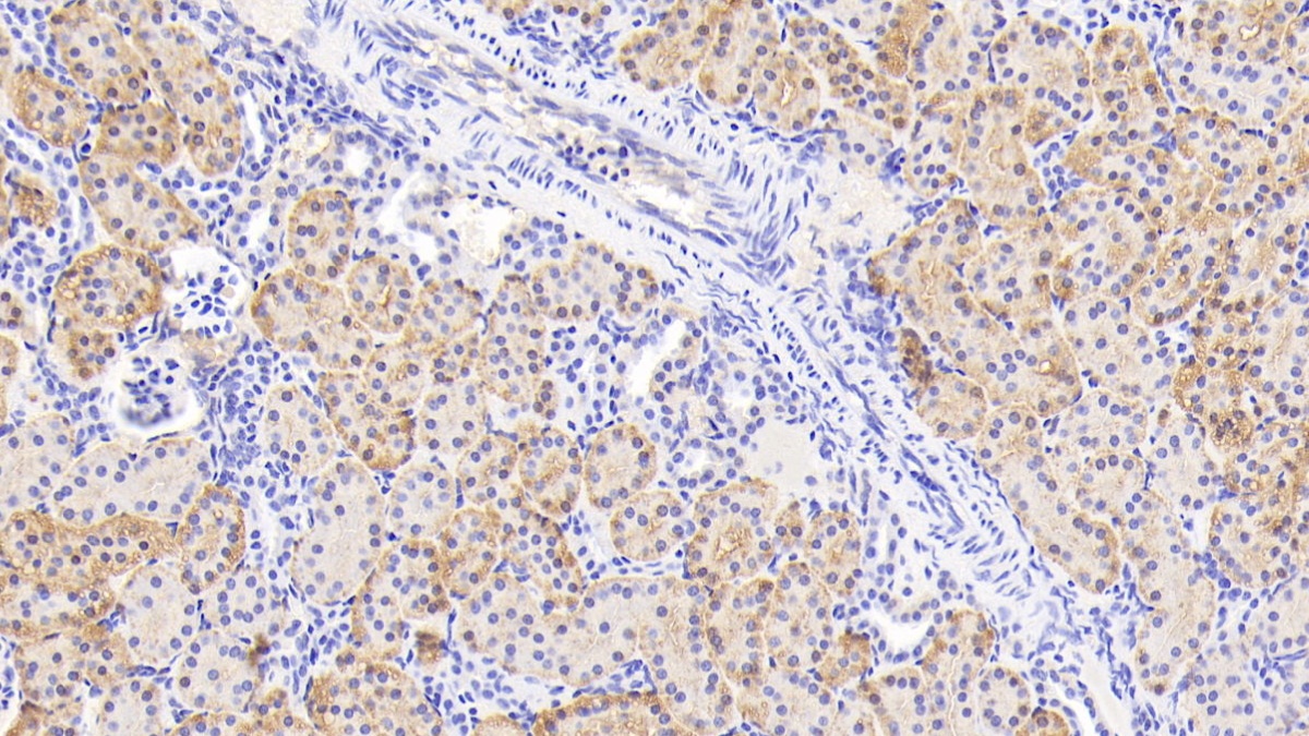 Tumor Necrosis Factor Ligand Superfamily, Member 13 (TNFSF13) Rhesus monkey (Simian) Polyclonal Antibody