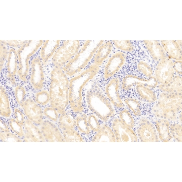 Major Histocompatibility Complex Class I E (MHCE) Human Polyclonal Antibody