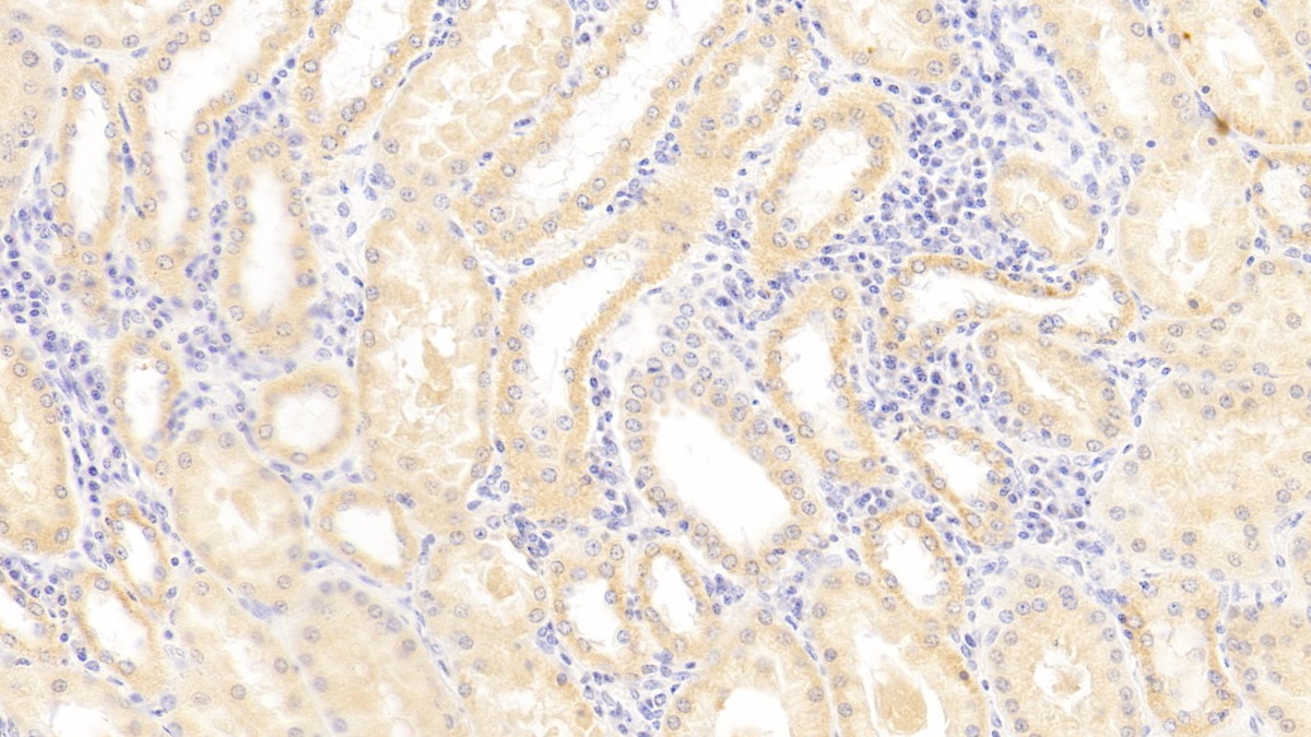 Major Histocompatibility Complex Class I E (MHCE) Human Polyclonal Antibody