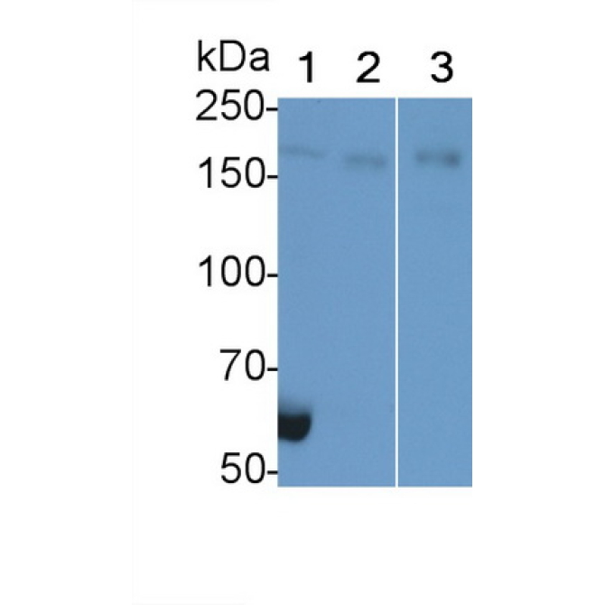 Glutamate Receptor Interacting Protein 1 (GRIP1) Human Polyclonal Antibody