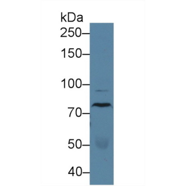 EGF Like Module Containing Mucin Like Hormone Receptor 2 (EMR2) Human Polyclonal Antibody