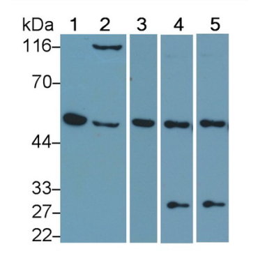 Interferon Regulatory Factor 4 (IRF4) Mouse Polyclonal Antibody