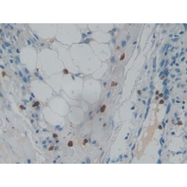 Ribonuclease A3 (RNASE3) Human Polyclonal Antibody