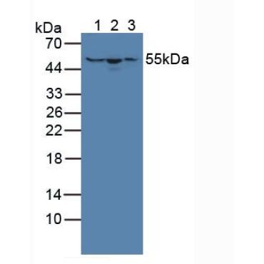 Hydroxymethylglutaryl Coenzyme A Synthase (HMGCS) Mouse Polyclonal Antibody