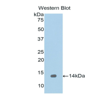 Regenerating Islet Derived Protein 1 Alpha (REG1a) Human Polyclonal Antibody