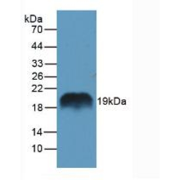Regenerating Islet Derived Protein 1 Alpha (REG1a) Mouse Polyclonal Antibody