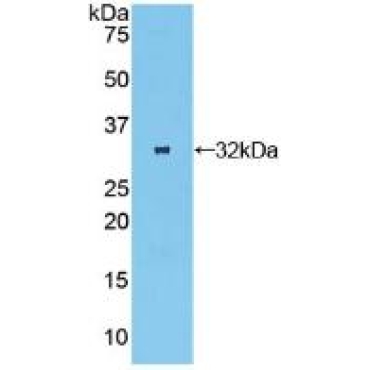 Oncostatin M Receptor (OSMR) Human Polyclonal Antibody