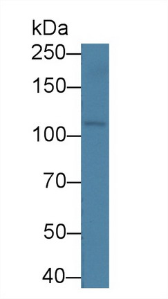 Oncostatin M Receptor (OSMR) Rat Polyclonal Antibody