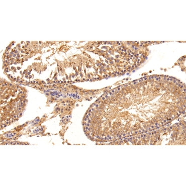 Inhibin Beta B (INHbB) Human Polyclonal Antibody