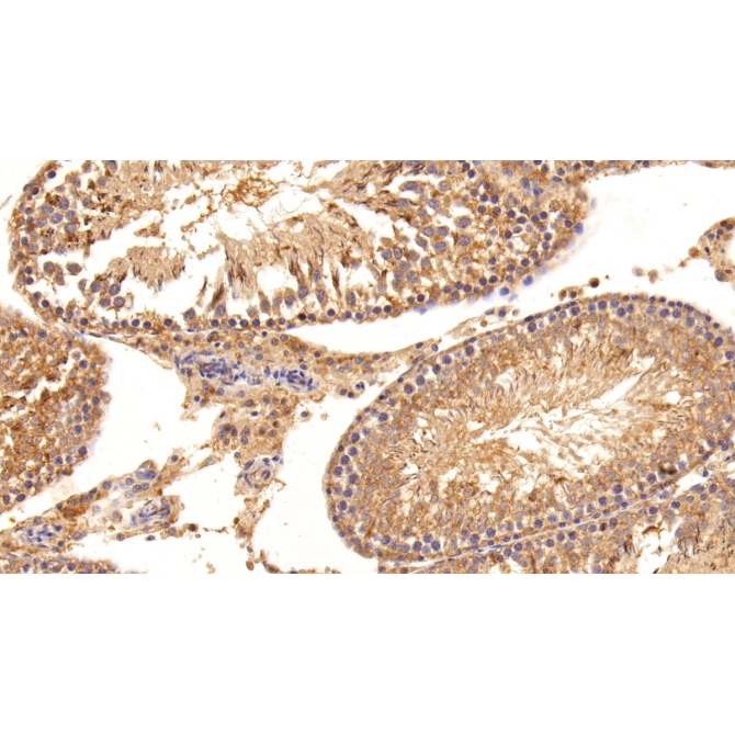 Inhibin Beta B (INHbB) Human Polyclonal Antibody