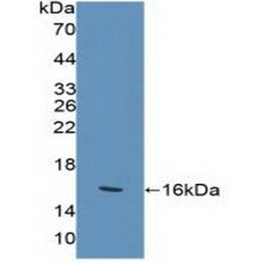 Killer Cell Lectin Like Receptor Subfamily K, Member 1 (KLRK1) Human Polyclonal Antibody