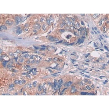 Lectin Galactoside Binding, Soluble 3 Binding Protein (LGALS3BP) Human Polyclonal Antibody