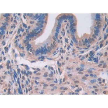 Lectin Galactoside Binding, Soluble 3 Binding Protein (LGALS3BP) Mouse Polyclonal Antibody