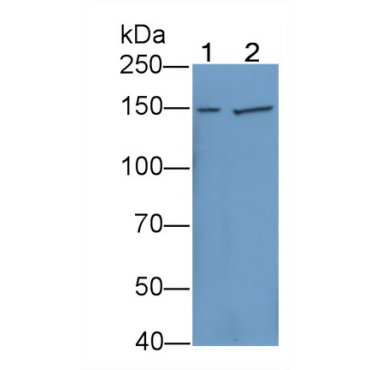 Prostaglandin F2 Receptor Negative Regulator (PTGFRN) Human Polyclonal Antibody