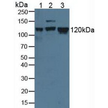Minichromosome Maintenance Deficient 2 (MCM2) Human Polyclonal Antibody