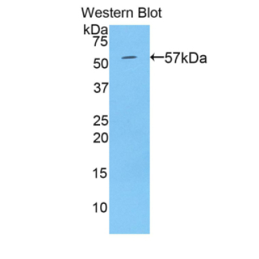 Transglutaminase 1 (TGM1) Human Polyclonal Antibody