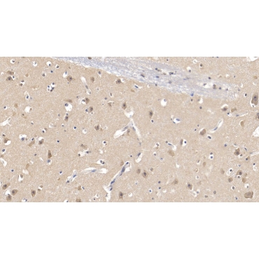 Transglutaminase 1 (TGM1) Human Polyclonal Antibody