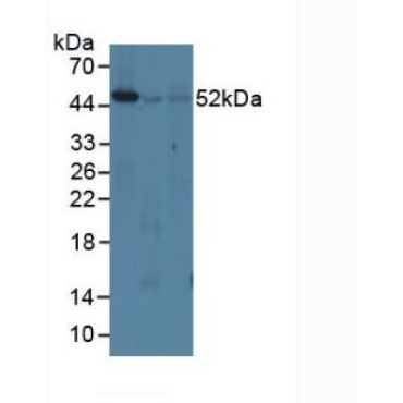 Interferon Regulatory Factor 8 (IRF8) Mouse Polyclonal Antibody