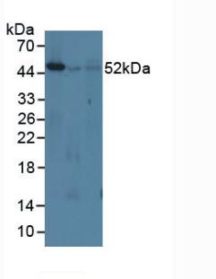 Interferon Regulatory Factor 8 (IRF8) Mouse Polyclonal Antibody