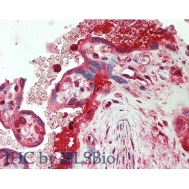 Orosomucoid 2 (ORM2) Human Polyclonal Antibody
