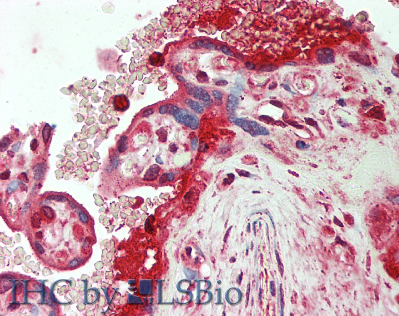 Orosomucoid 2 (ORM2) Human Polyclonal Antibody