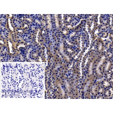 Orosomucoid 2 (ORM2) Mouse Polyclonal Antibody