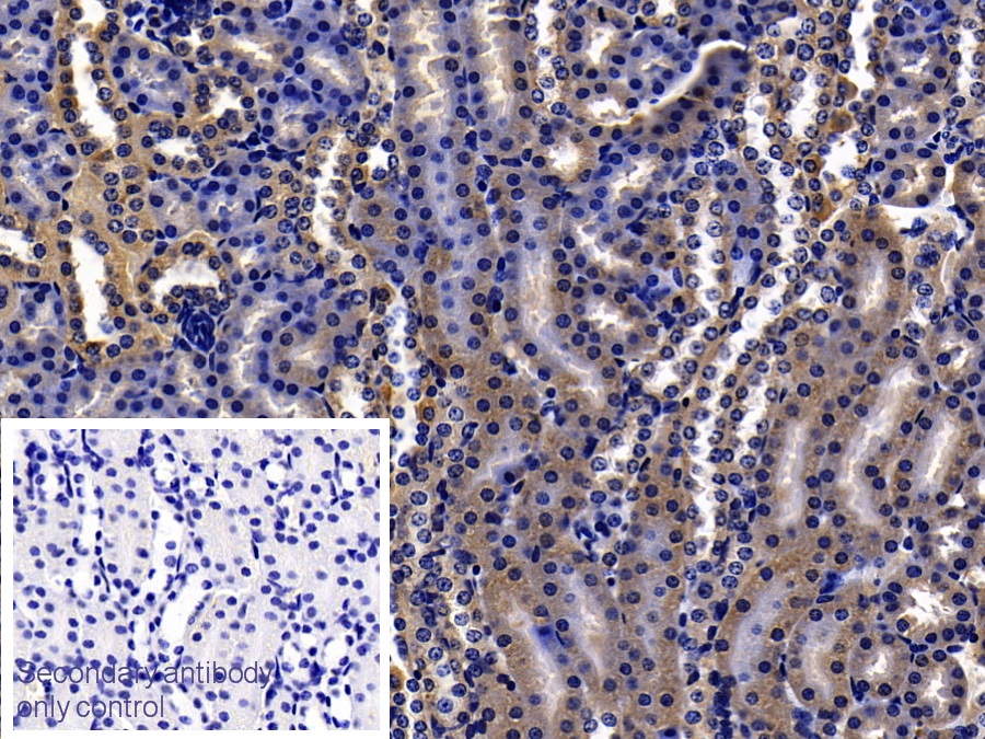 Orosomucoid 2 (ORM2) Mouse Polyclonal Antibody