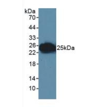 Junctional Adhesion Molecule 1 (JAM1) Human Polyclonal Antibody