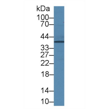 Junctional Adhesion Molecule 2 (JAM2) Human Polyclonal Antibody