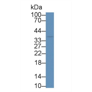 Cluster Of Differentiation 7 (CD7) Human Polyclonal Antibody