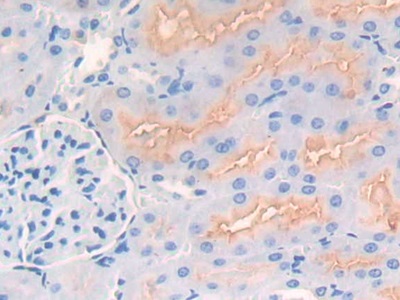 Neprilysin (CD10) Rat Polyclonal Antibody