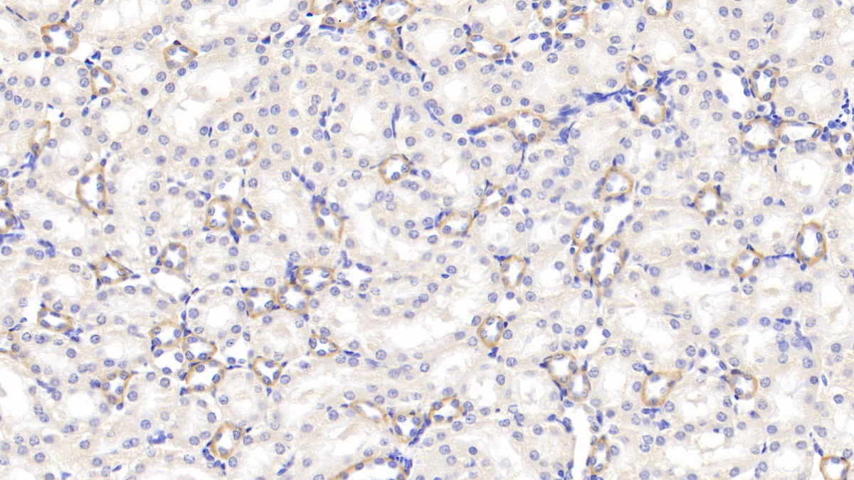 Receptor Interacting Serine Threonine Kinase 2 (RIPK2) Rat Polyclonal Antibody