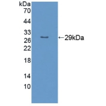 Rho Family GTPase 1 (RND1) Human Polyclonal Antibody