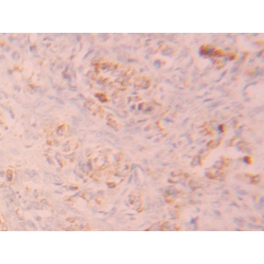 Fibroblast Growth Factor Receptor 1 (FGFR1) Human Polyclonal Antibody