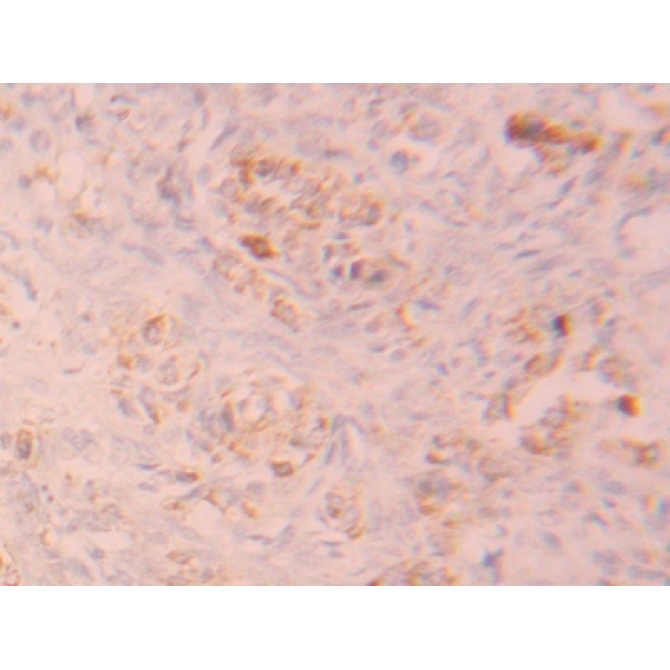 Fibroblast Growth Factor Receptor 1 (FGFR1) Human Polyclonal Antibody