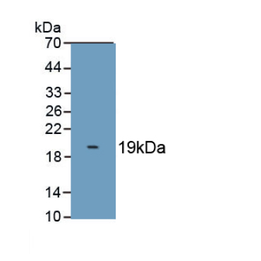 S100 Calcium Binding Protein A8 (S100A8) Bovine (Cattle) Polyclonal Antibody
