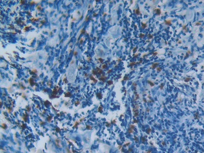 S100 Calcium Binding Protein A8 (S100A8) Human Polyclonal Antibody