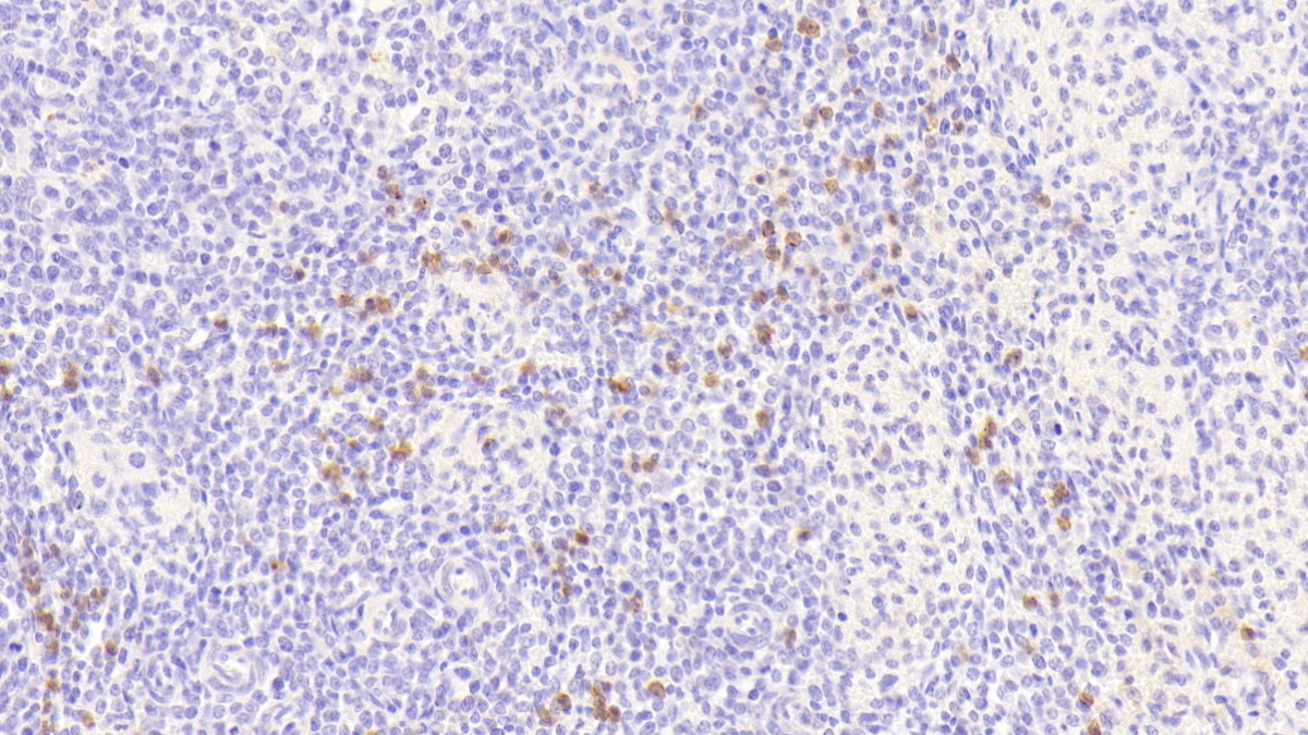 S100 Calcium Binding Protein A8 (S100A8) Human Polyclonal Antibody