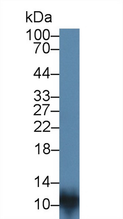 S100 Calcium Binding Protein A8 (S100A8) Rabbit Polyclonal Antibody
