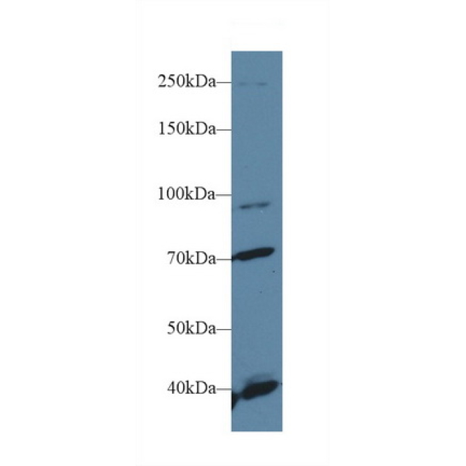 Fibroblast Growth Factor Receptor 2 (FGFR2) Human Polyclonal Antibody