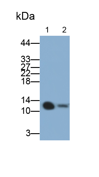 Serum Amyloid A2 (SAA2) Human Polyclonal Antibody