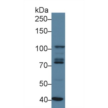 Signal Transducer And Activator Of Transcription 2 (STAT2) Human Polyclonal Antibody