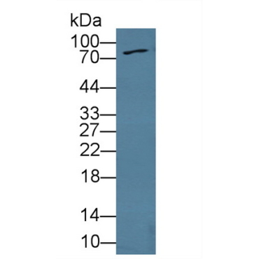 Fibroblast Growth Factor Receptor 4 (FGFR4) Mouse Polyclonal Antibody