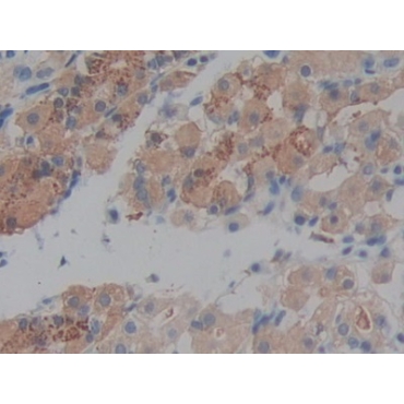 Prekallikrein (PK) Human Polyclonal Antibody