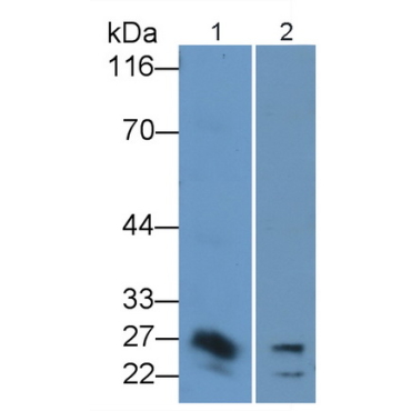 Interleukin 32 (IL32) Human Polyclonal Antibody