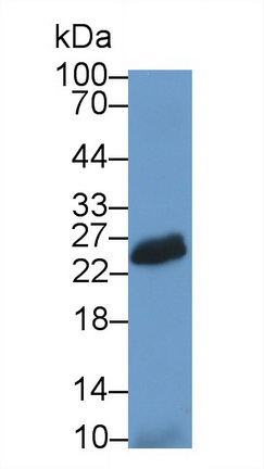 Natural Cytotoxicity Triggering Receptor 2 (NCR2) Human Polyclonal Antibody
