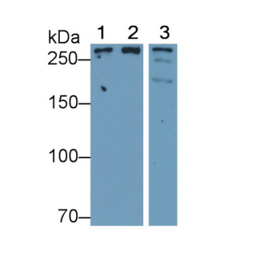 Serine/threonine-protein kinase mTOR (mTOR) Human Polyclonal Antibody