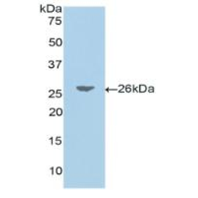 Jagged 1 (JAG1) Human Polyclonal Antibody